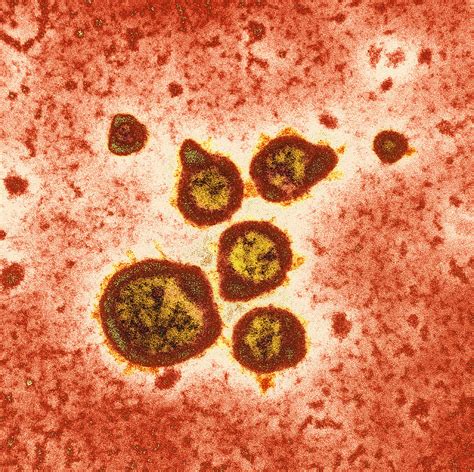 Respiratory Syncytial Virus Tem Photograph By Hazel Appleton Centre