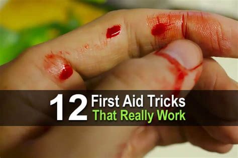 12 Most Important First Aid Skills To Learn First Aid First Aid Tips