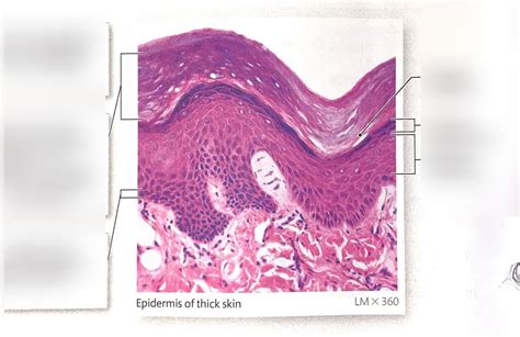 A P Practical Labeling Thick Skin Slide Skin Layers Diagram