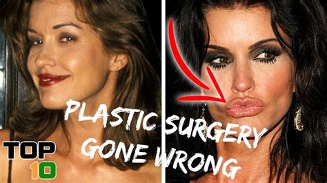 Top 10 Celebrity Plastic Surgeries Gone Wrong Youtube