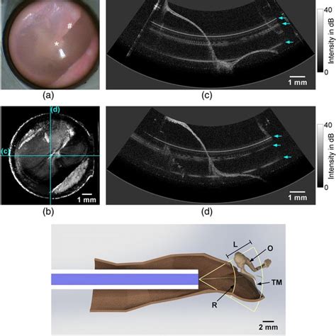 Pdf Endoscopic Optical Coherence Tomography With Wide Field Of View