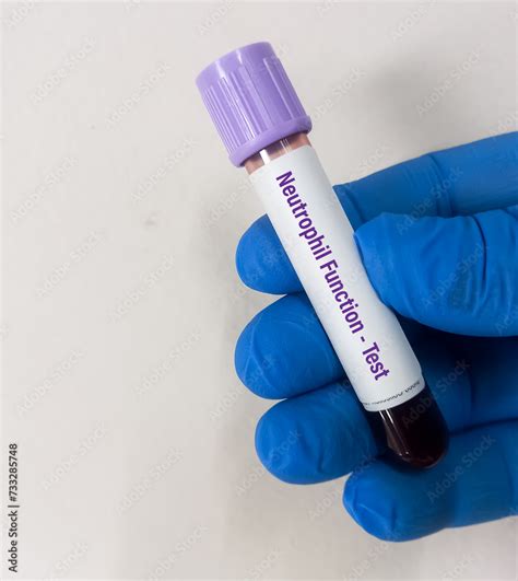 Blood Sample For Neutrophil Function Test Or Dihydrorhodamine Dhr