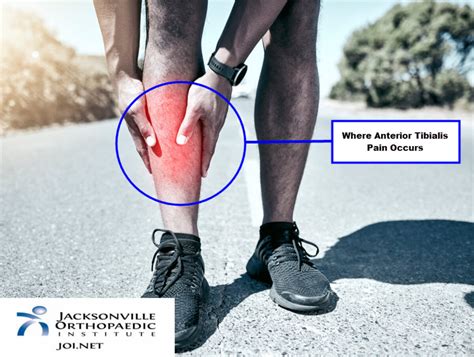 Anterior Tibial Tendonitis