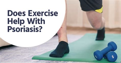 Does Exercise Help With Psoriasis? — Core Med Science