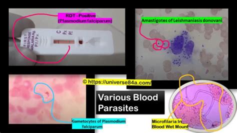 Blood Parasite Introduction Morphology Pathogenicity Lab Diagnosis