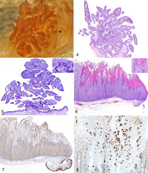 Squamous Papillomas Of The Conjunctiva In Dogs A Condition Not