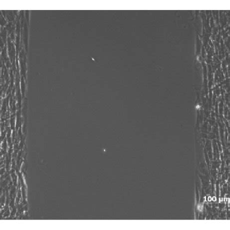 images  cell migration images show  time    migration