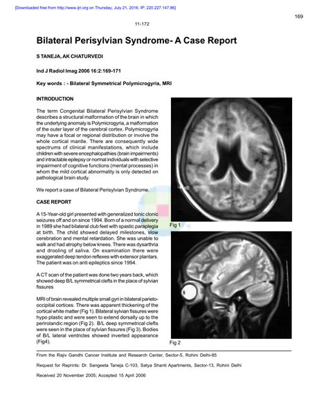 Pdf Bilateral Perisylvian Syndrome A Case Report