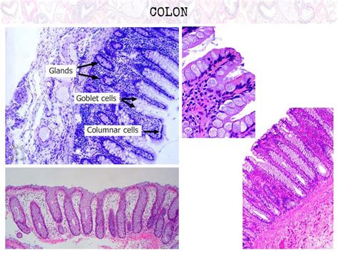 A Histology Tour Of The Gi Tract The Colon Rectum And Anus Free