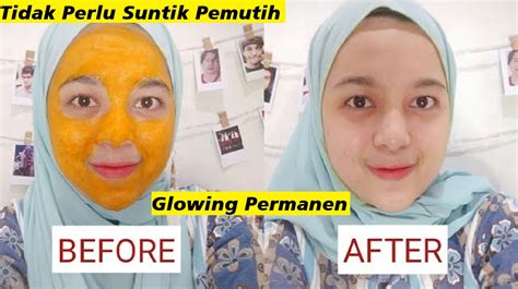 Ingin Awet Muda Begini Cara Membuat Masker Kunyit Untuk Memutihkan