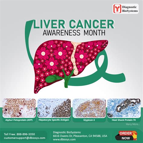 Liver Cancer Awareness Month Diagnostic Biosystems Advanced Tissue Diagnostics And Trusted