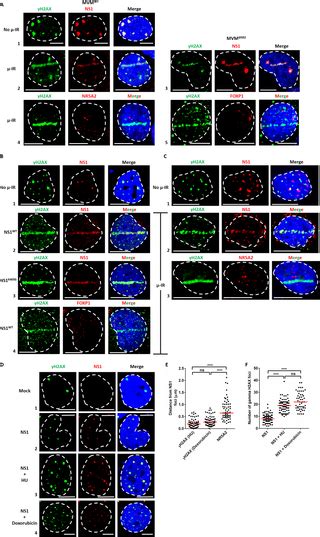 The Ns1 Protein Of The Parvovirus Mvm Aids In The Localization Of The