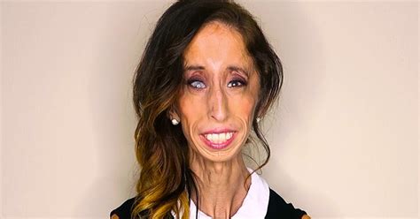 Welcome To Adamslink Media Meet The Lady Branded World S Ugliest Woman Lizzie Velasquez