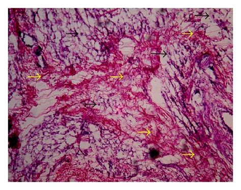 Histopathology Of Granulation Tissue At Day 10 Stained With Hande 100x Download Scientific