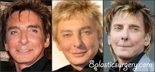 Barry Manilow Plastic Surgery