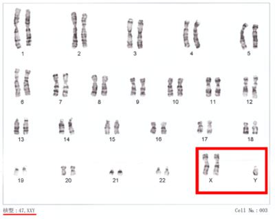 Klinefelter Syndrom Klinik Und Genetik Lecturio