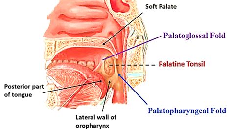 Palatine Tonsil – Anatomy QA