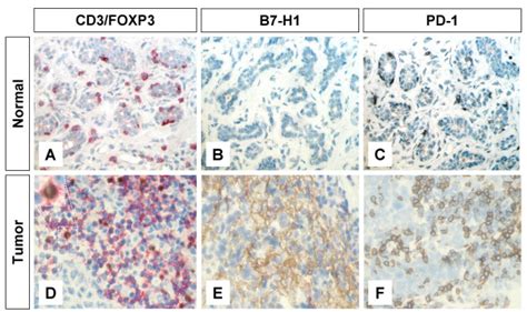 Immunohistochemical Staining Of Foxp Tregs B H And Pd In T