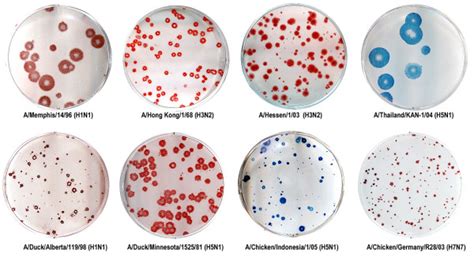 Plaques Formed By Influenza Viruses In Mdck Cells Under Avicel