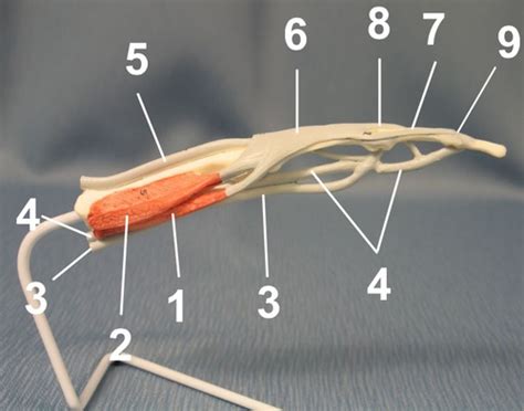 Extensor Hood Mechanism Flashcards | Quizlet