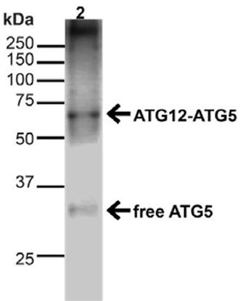 atg polyclonal antibody invitrogen  ug
