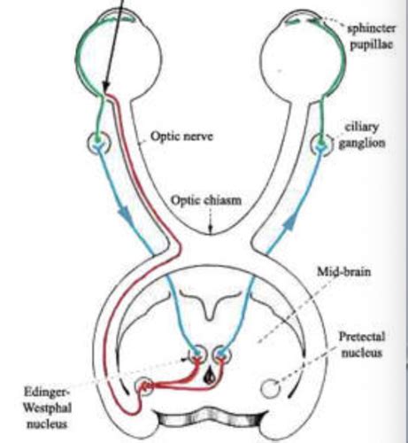 Lecture 19 Clinical Eye Ear Vision PI Slides Lab 7 Eye And Ear