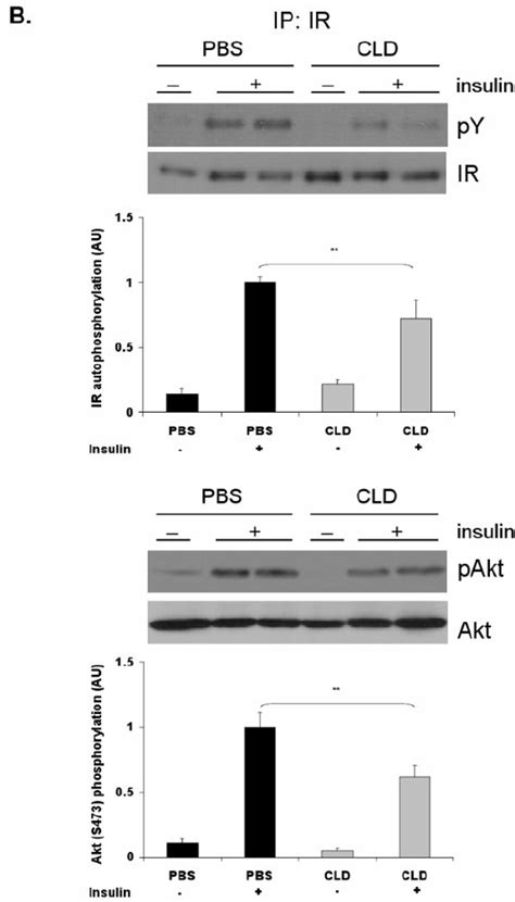 Kupffer Cell Ablation In Dio Mice Is Associated With Impaired Hepatic