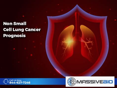 Non Small Cell Lung Cancer Prognosis