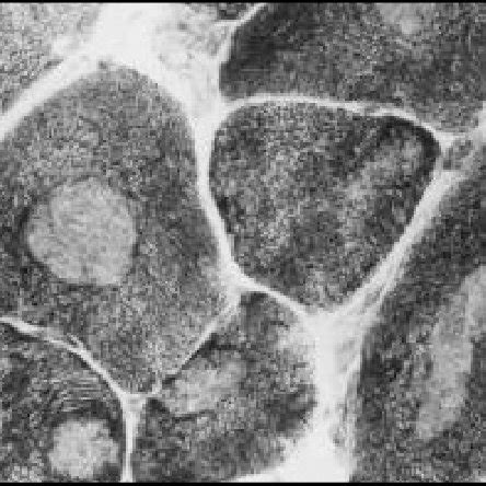 Muscle Biopsy With Histochemical Reaction For Nadh Tr X Showing