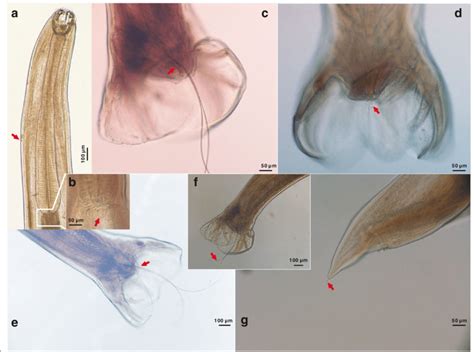 Photomicrographs Of Adults Of Ancylostoma Ailuropodae N Sp A