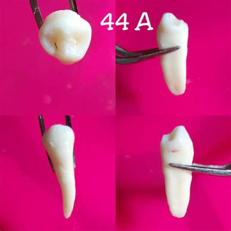 Jual Gigi Premolar Rahang Bawah Shopee Indonesia