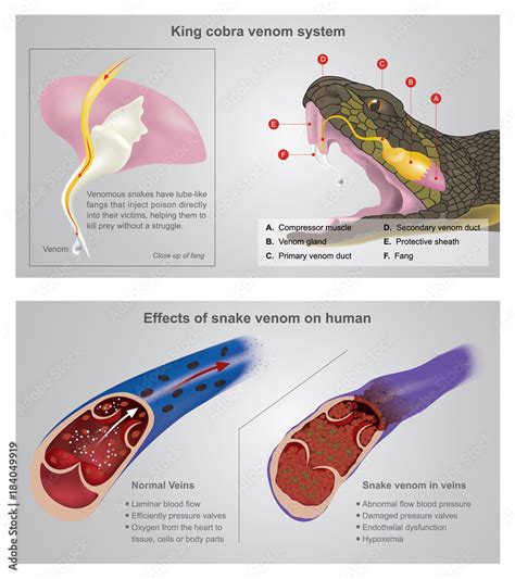 King cobra venom system. Venomous snakes have tube-like fangs that ...