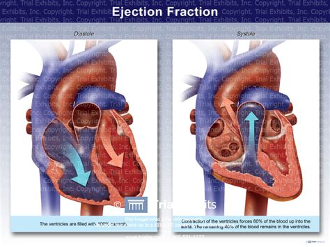 Ejection Fraction - TrialQuest Inc.