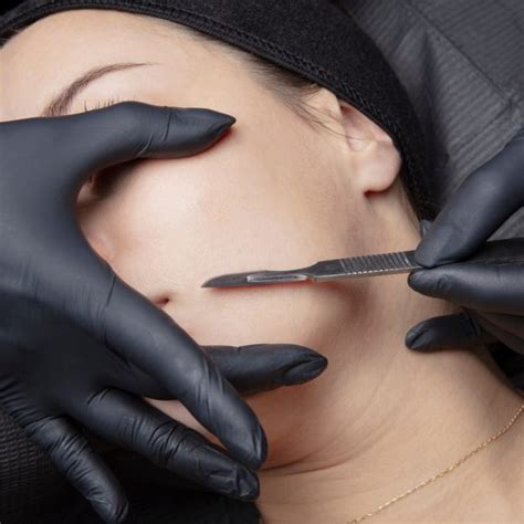 Dermaplaning Dash Aesthetics Aberdeen