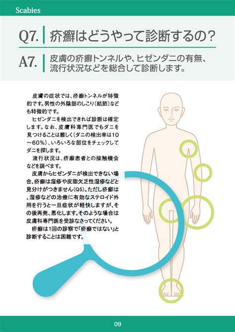 疥癬（かいせん） Q7 皮膚科q＆a（公益社団法人日本皮膚科学会）