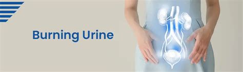 Burning Urine (Dysuria) : Symptoms, Causes & Treatment Methods