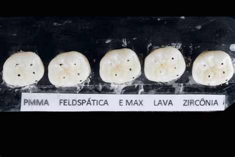 Valida O Da T Cnica De Ajuste Oclusal Uso De Inserto Diamantado