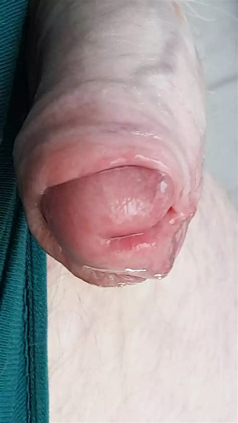 Edging Milking Foreskin Play And Loads Of Cum Gay Amateur Porn XHamster