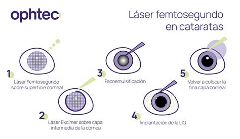 Láser femtosegundo su aplicación en la cirugía de cataratas Ophtec