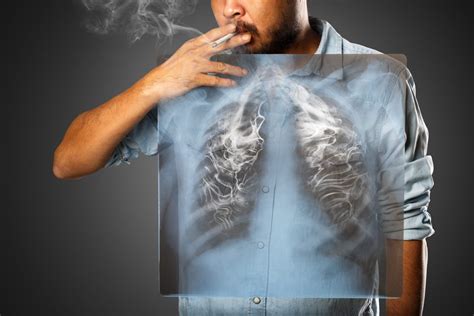 7 Health Effects Of Smoking on Body & Mind - PharmEasy