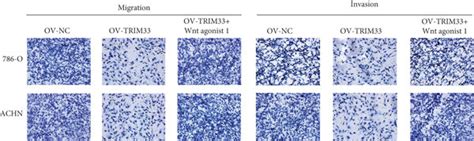 Trim33 Overexpression Can Inhibit Migration Invasion And Emt In Download Scientific Diagram