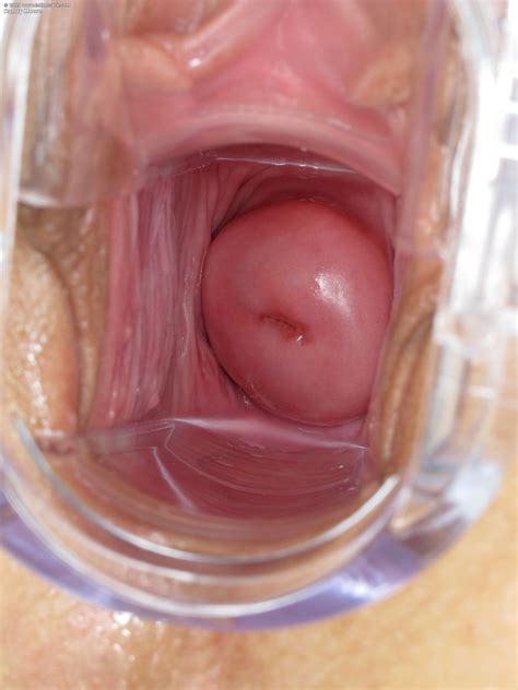 Vaginal Speculum Naked Girls Speculum Close Up