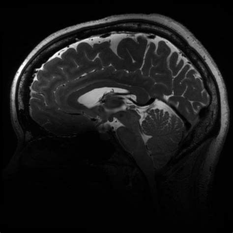 Magnetic Resonance Research Facility Carver College Of Medicine The