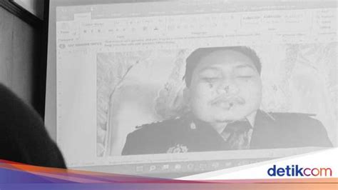 Potret Jenazah Yosua Ditampilkan Di Sidang Ada 2 Luka Di Wajah