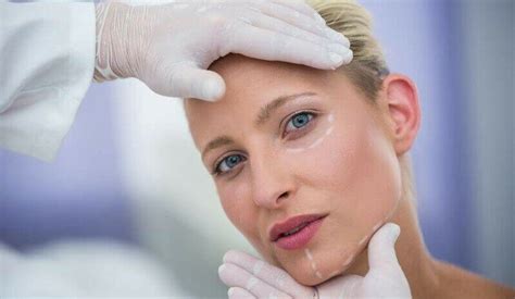 RF-лифтинг лица: проведение процедуры, плюсы и минусы