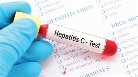 Mengenal Hepatitis C Atau Penyakit Kuning Penyebab Gejala Dan