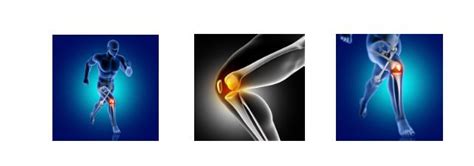 knee strain  sprain  tear      dranjani