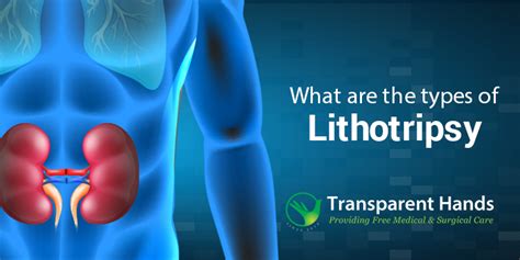 Types of Lithotripsy and its Procedure, Costs and Side Effects