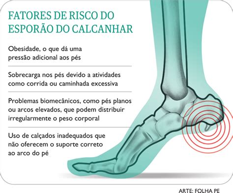 Esporão no calcanhar o que é quais sintomas e como prevenir Folha PE