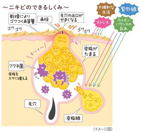 即効治したい【鼻ニキビの原因と対処法】赤い・痛い炎症はどうして起こる？ Oggi Jp